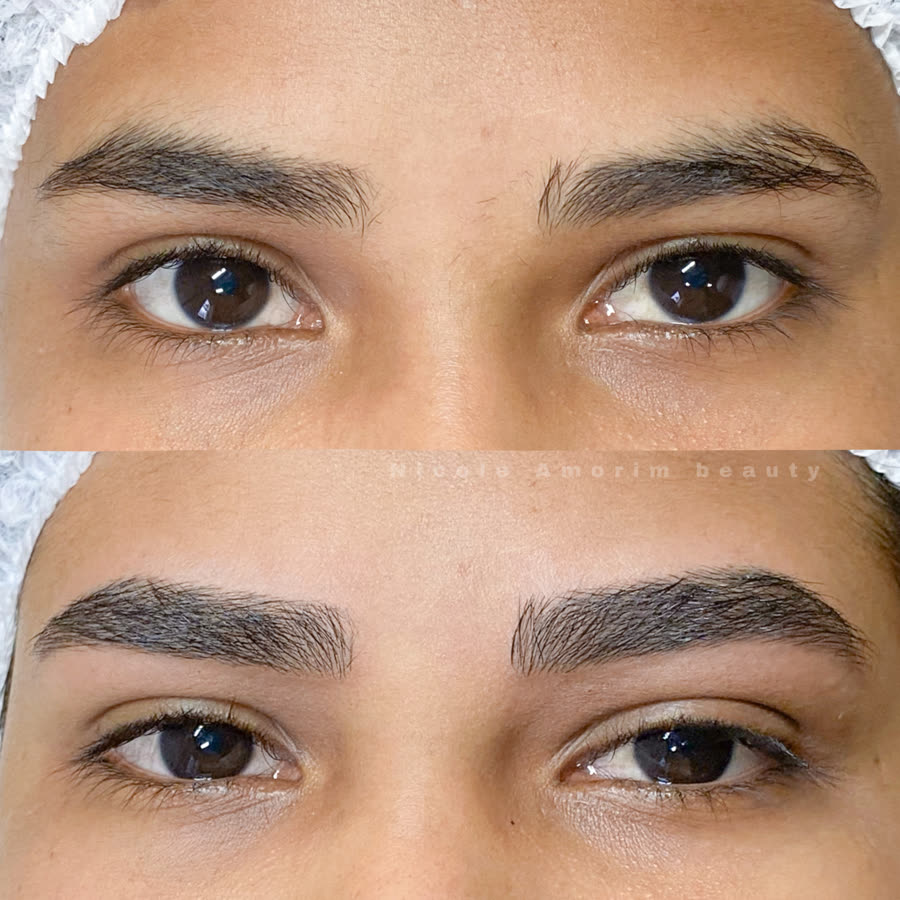 Antes e depois de nanofios: sobrancelha mais preenchida e definida