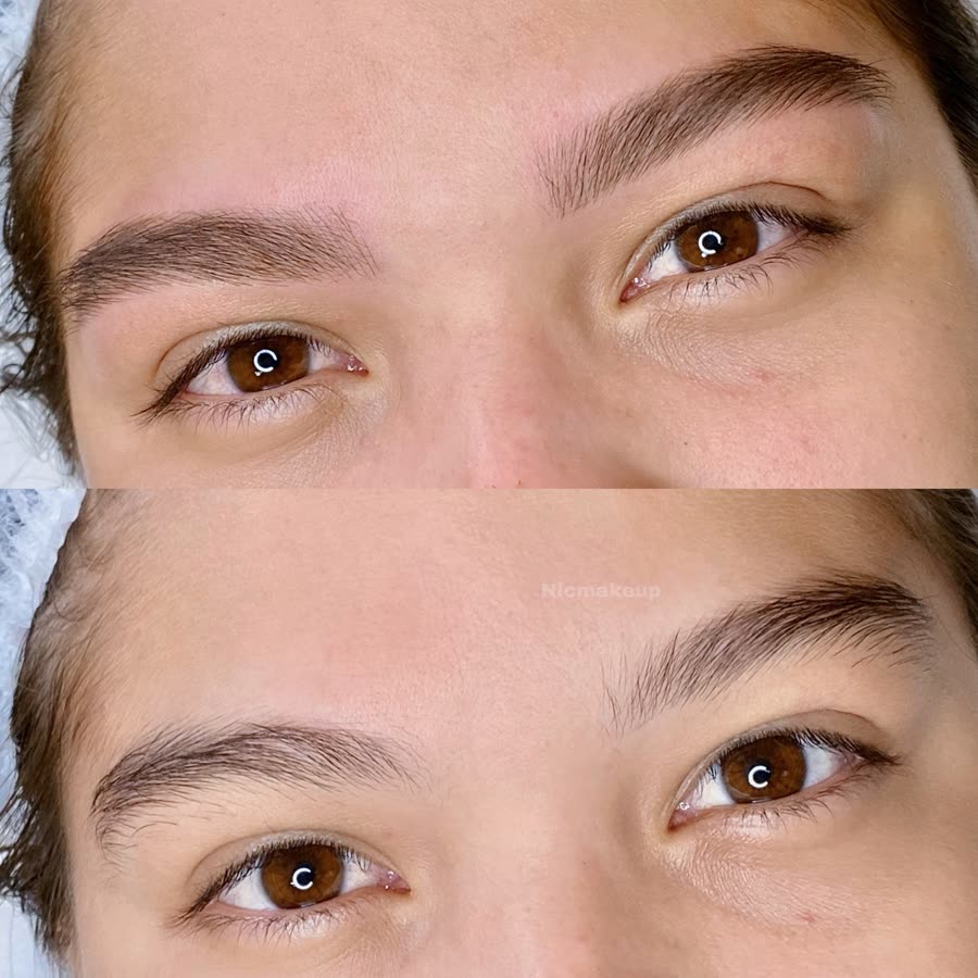 Antes e depois de nanofios em sobrancelha fina