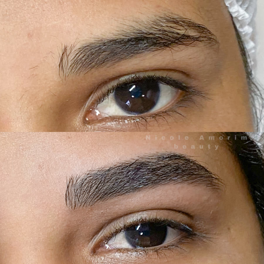 Antes e depois de nanofios com sobrancelha encorpada