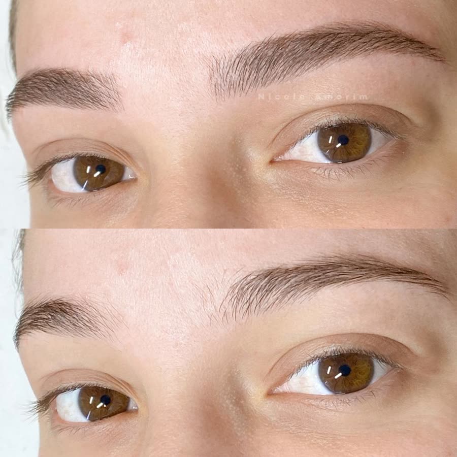 Antes e depois de nanofios em sobrancelha clara